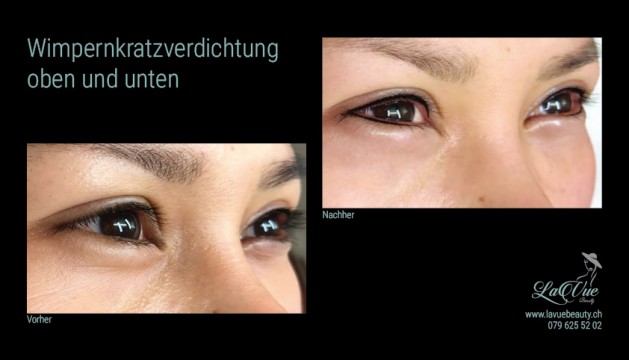 Wimpernkranzverdichtung oben und unten Vorher Nachher Bild MICRONEEDLING PERMANENT MAKE UP MICROBLADING THUN BERN