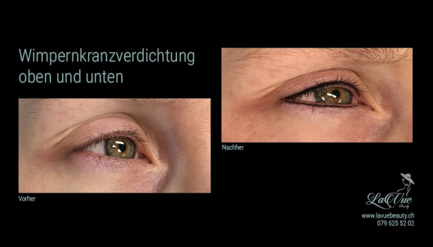 Wimpernkranzverdichtung oben und unten Vorher Nachher Bild MICRONEEDLING PERMANENT MAKE UP MICROBLADING THUN BERN