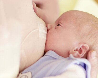 A mom breastfeeding her baby and supplementing the diet using Medela's Supplemental Nursing System™ (SNS).