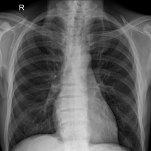 chest radiograph