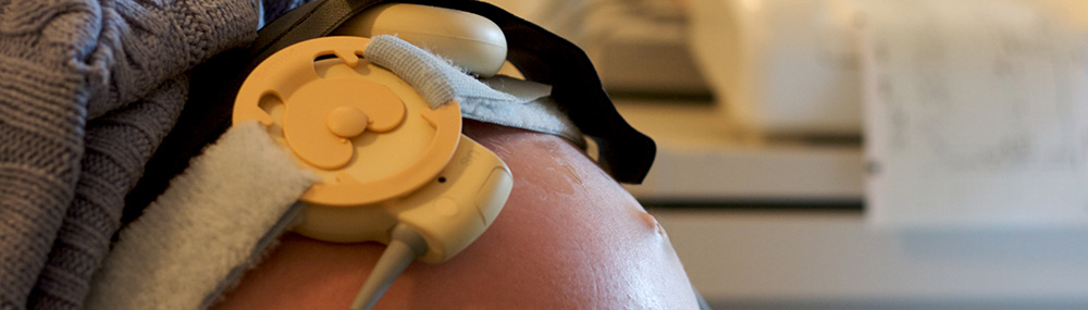 Sensors attached to a pregnant patient’s abdomen in a medical exam room.